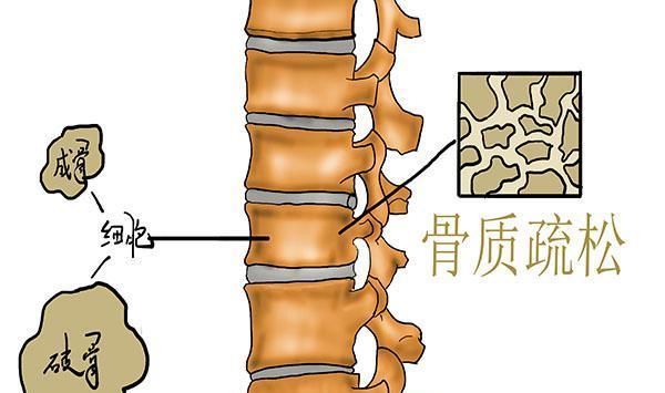  增强|增强骨密度的高手，其实不是牛奶，经常吃，骨量增加，骨骼更强健