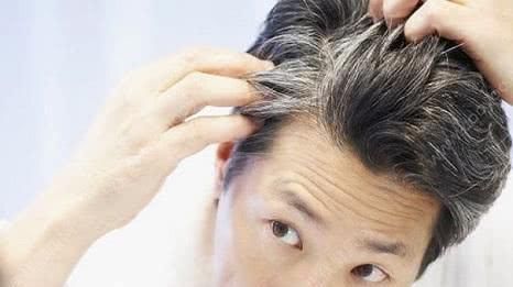 芝麻梗|天然的“染发剂”被找到了, 洗头时加一点, 白发慢慢黑回来