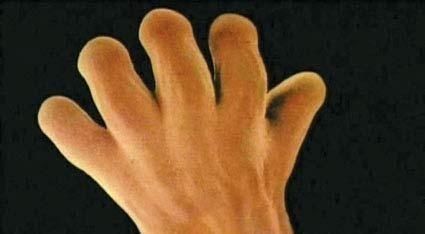 胎儿|怀孕几周最危险尤其是这两个时期,孕妇一定要知道