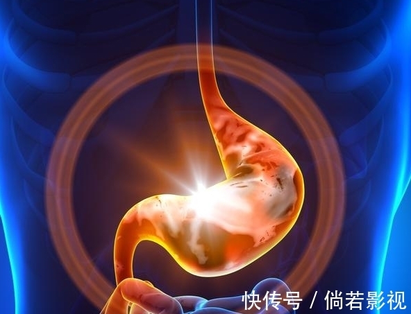 胃肠|小米粥是胃病的“清洁剂”?建议:若想养胃,3种食物要少吃