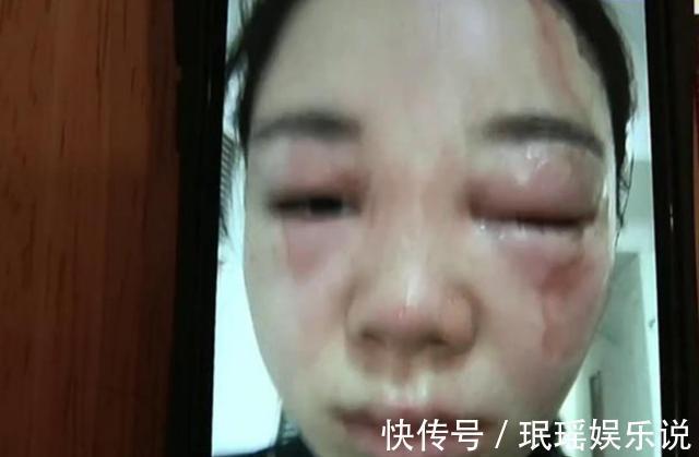 花40块买的榨汁机，刚倒入开水就被炸了一脸，姑娘：我靠脸吃饭的