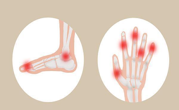 尿酸|蔬菜中也会有“嘌呤大户”？以下几种蔬菜，高尿酸患者尽量少吃