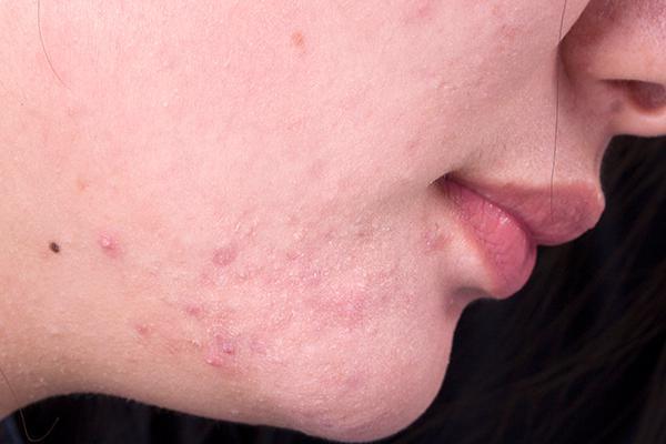 抗衰老|每天吃粒维生素E,能抗衰老女子坚持3个月的结果,告知答案