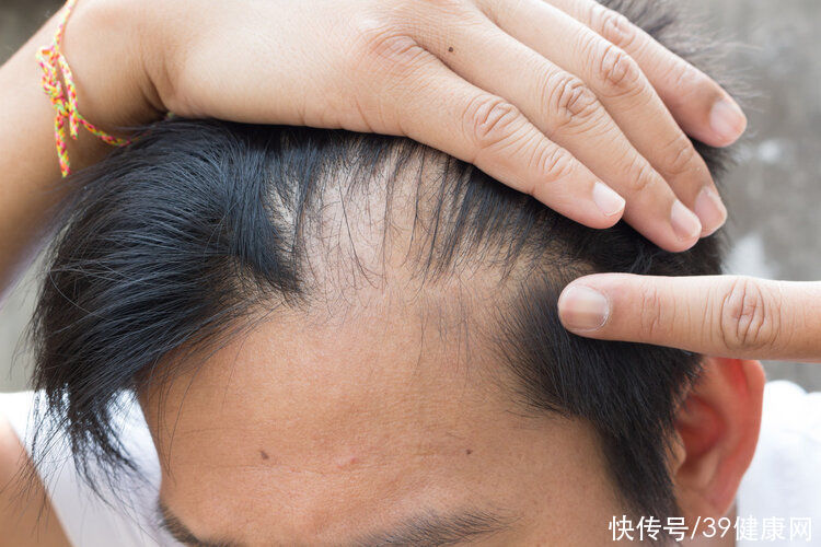 效果|?动辄好几万的植发，值不值得做？医生：效果很难保证