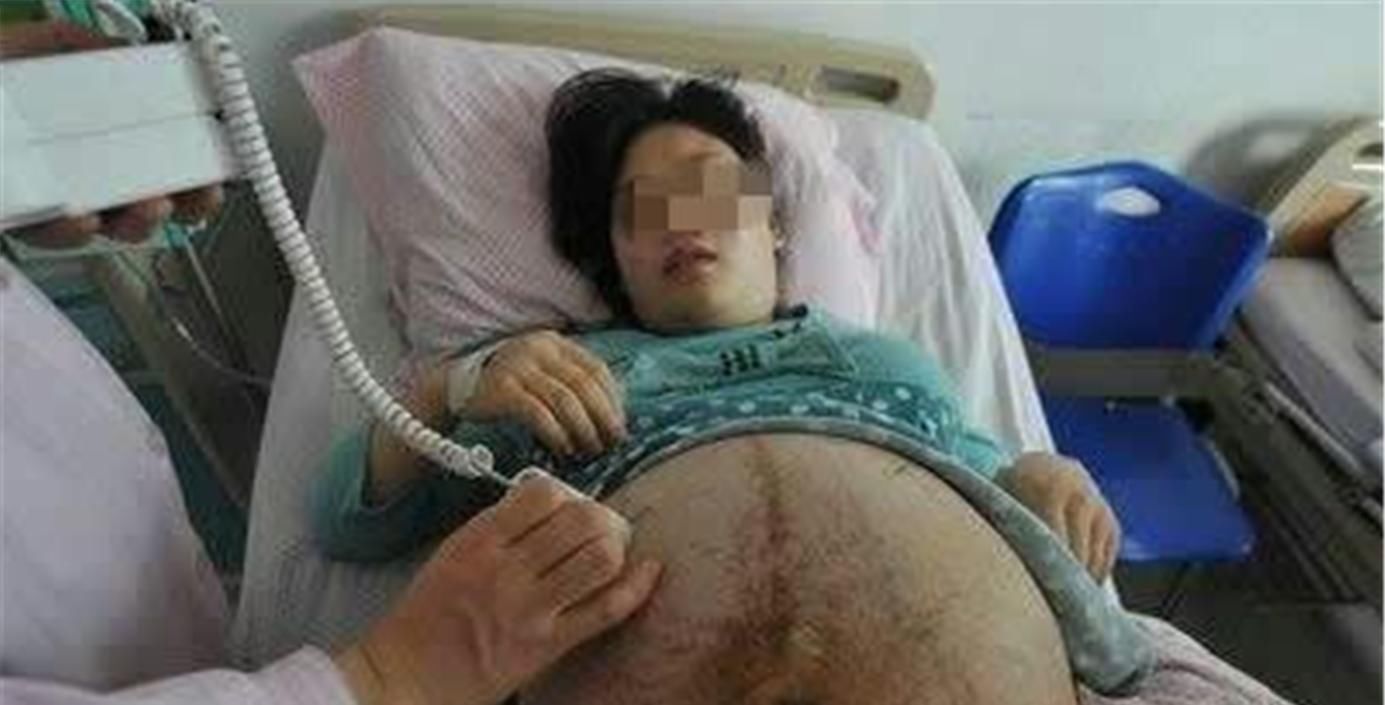 双胞胎|90后孕妈顺产三胞胎，缝合时大喊“还有一个”，把医生都逗笑了