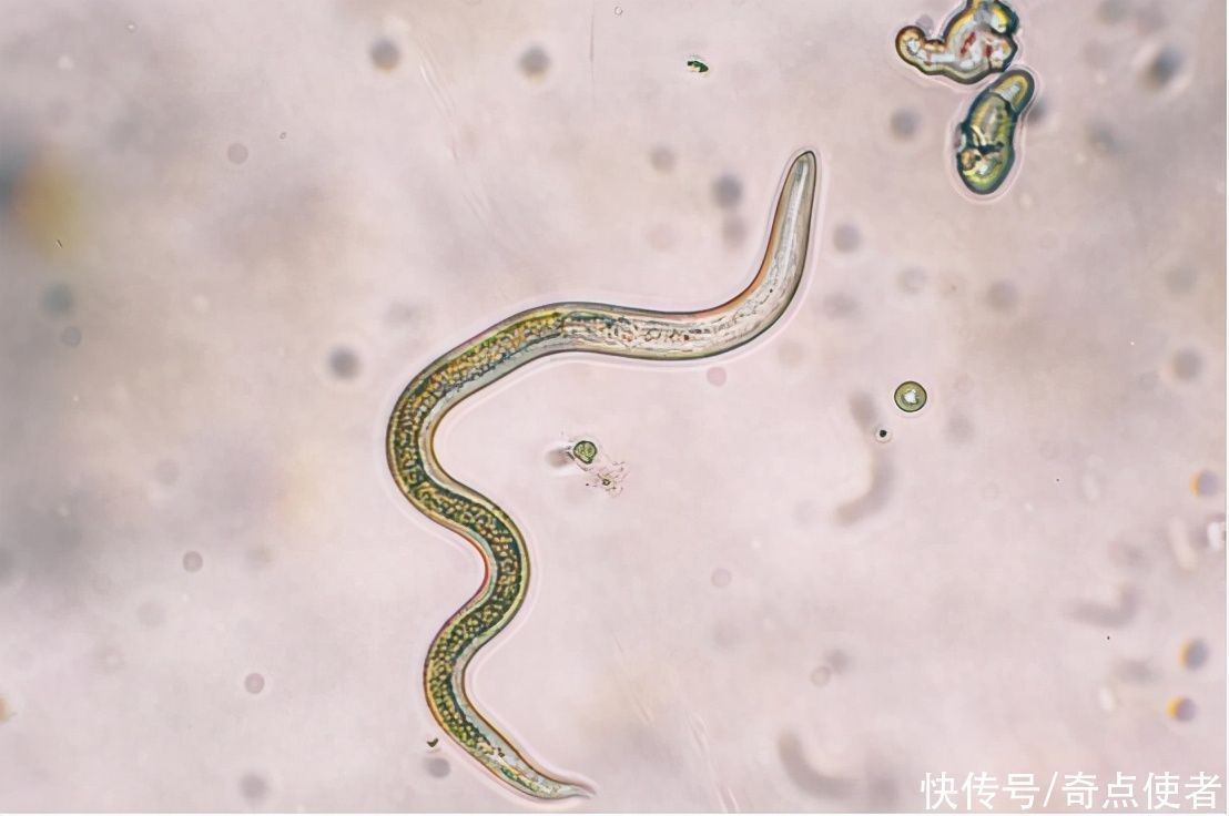 蛔虫|在过去,很多人肚子里都有“蛔虫”,为什么现在却看不到了?