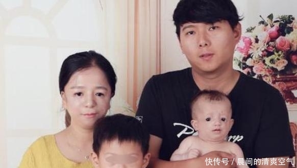 缺陷|女子天生“鸟脸”,却非要生二胎,网友:躲得过初一,躲不了十五
