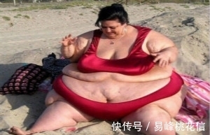 怀孕|女子体重500斤,怀孕时肚子异常肿大,生出的孩子医生不淡定