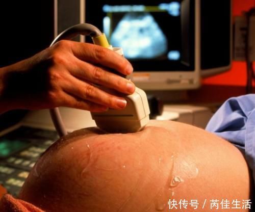 胎动|孕肚中的胎儿“会说话”?发出这几种胎动,可能是智商“潜力股”