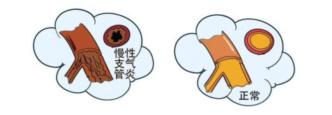 今日小寒：处三九日大雪厚半尺