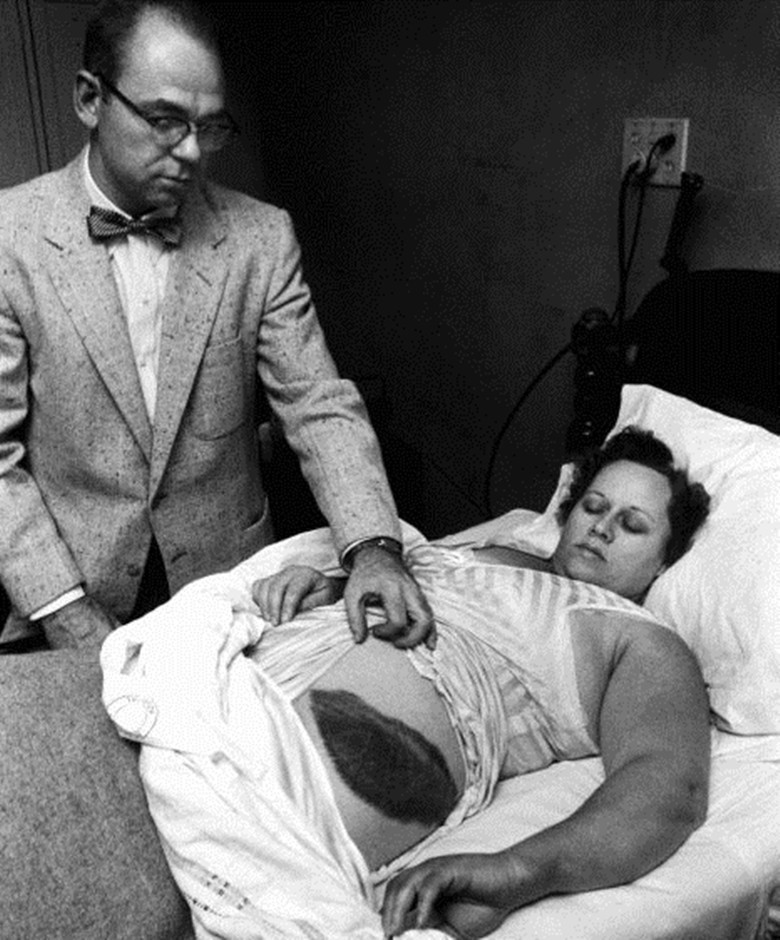 安·霍奇斯 唯一一个被陨石砸中的人:本可卖出高价,最后捐给了博物馆