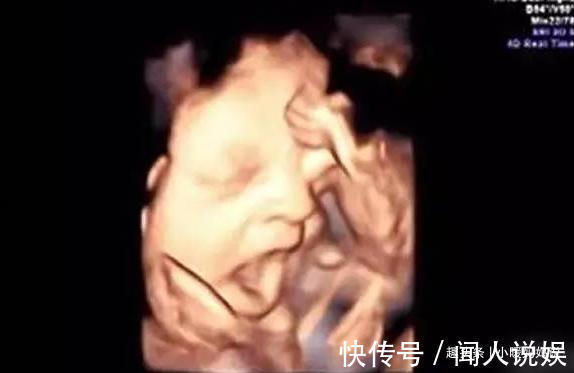 宝宝|7个月宝妈做产检,医生当场就笑翻了,孕妈等出生看老娘收拾你