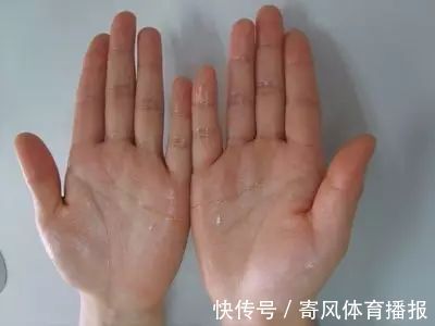 汗证|汗从哪里出，病从哪里来！夏天爱出汗的，快对照看看吧！