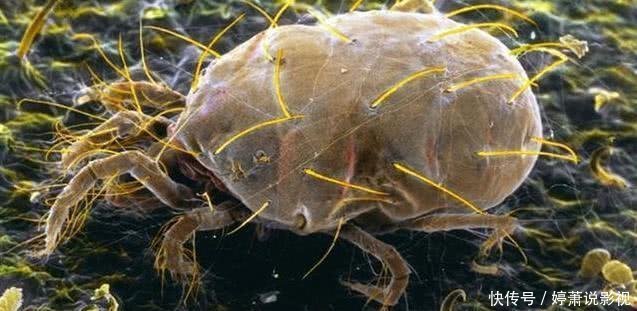 蔬菜|宁可吃肉,也不要吃这“3种蔬菜”,寄生虫“成堆”,细思极恐