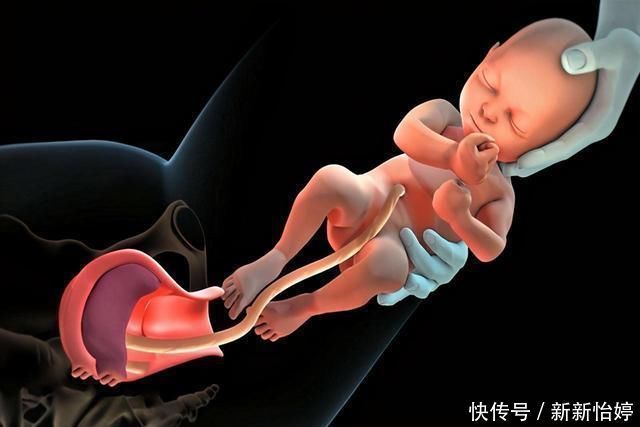 宝妈|顺产和剖腹产该怎么选？各有各的优点，但有几种情况要选择剖腹产