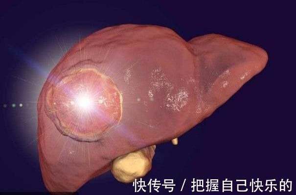 肝脏|肝不好的人，睡觉时会有“1痒，2痛，3多”，若没有，肝脏还不错