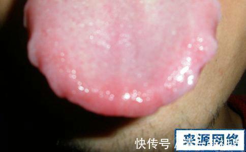 温脾阳|湿气的“七寸”在哪里你抓对了吗湿重，少做3事，贵在坚持