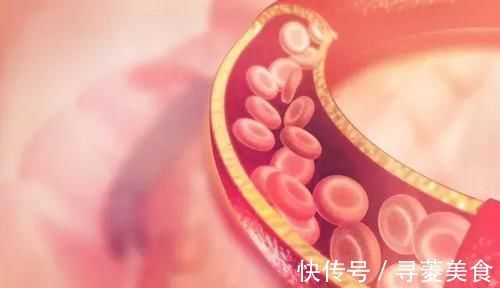 肌腱|血脂高的人，身体可能会有6个表现，多吃两物，帮你平稳血脂！