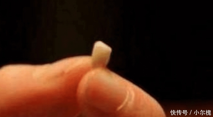 家长们|孩子七岁时候的乳牙,家长们不要乱丢,关键时刻能救孩子一命