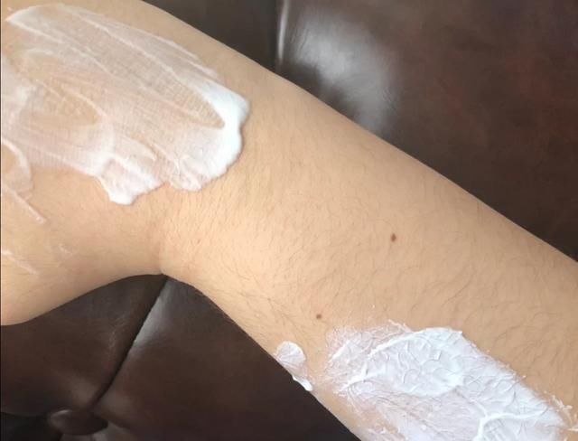 手臂和小腿容易有鸡皮日常做好4点,鸡皮离你远远的