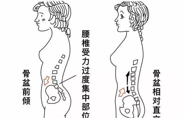 体态|不注意这几个体态问题,永远也不可能拥有好身材!