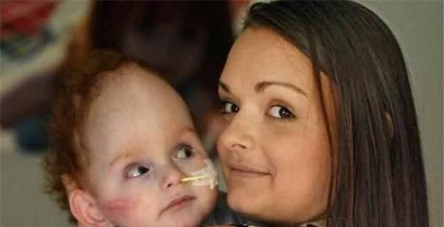 十月怀胎|婴儿天生没大脑,医生建议安乐死,如今被妈妈宠成小天使