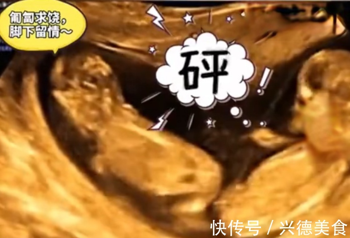 外面的世界|孕妈做四维彩超时突然腹痛,B超显示让人忍俊不禁,网友:挺无辜