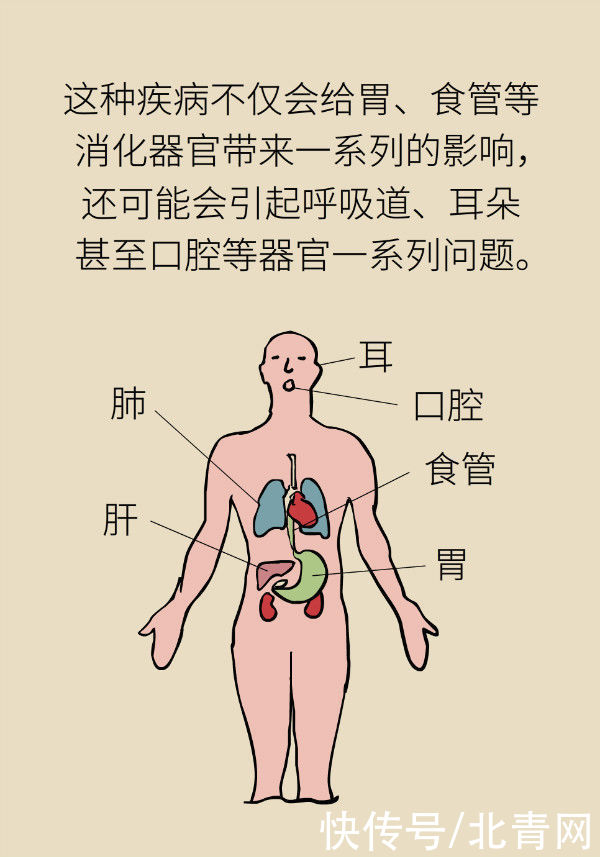 养胃|喝稀饭能养胃?警惕胃酸反流胃更烧