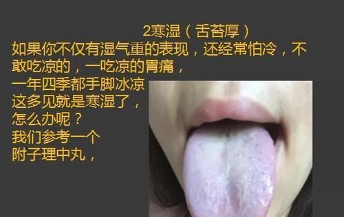 齿痕|齿痕重是脾虚，舌苔厚也是脾虚吗？怎样把舌苔变薄、齿痕消失呢？