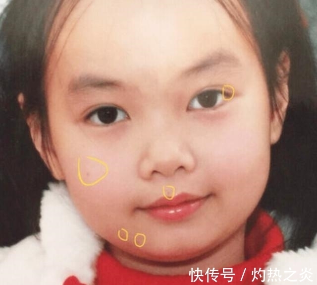 福气|宝宝身体这几个部位有痣,可能是有“福气”的表现,你家娃中了没