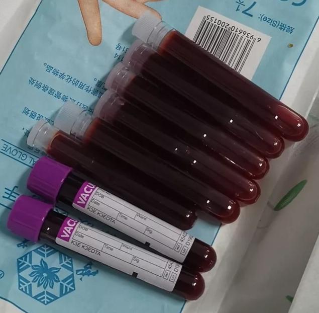 轮椅|16岁初中生突然不能活动,医生从他体内抽出红色液体