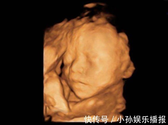 手段|孕妈做“四维”前,这3件事最好要提前了解,不然可能就是白花钱