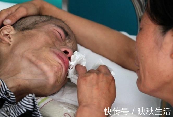 痊愈|患癌后想要痊愈,多半会经历2大“生死坎”,熬过去都不是简单人