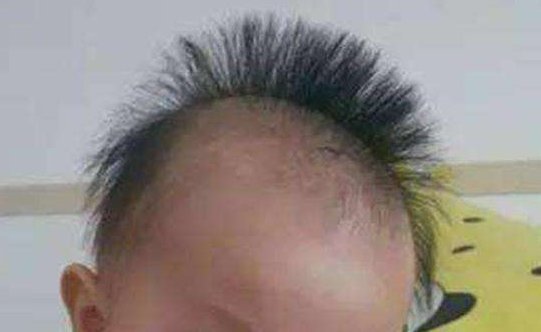 宝宝|宝宝头发竖着长代表发育好？错！遇上这几种情况可能身体亮了红灯