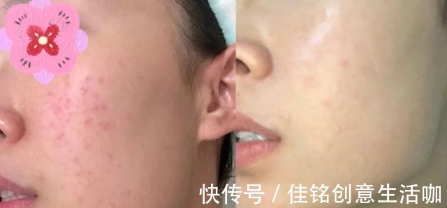 皮肤 孕期护肤品推荐孕妈不要错过这5款,看着不起眼,但特别好用!