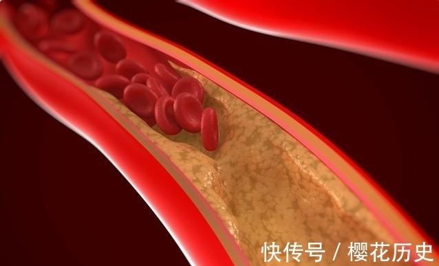 食物|有4种食物是降血脂帮手,甘油三酯、胆固醇高,多吃会慢慢降下去