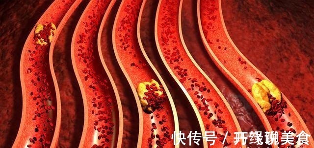 花生|生花生和熟花生,哪个更营养提醒5类人最好少碰,别不当回事