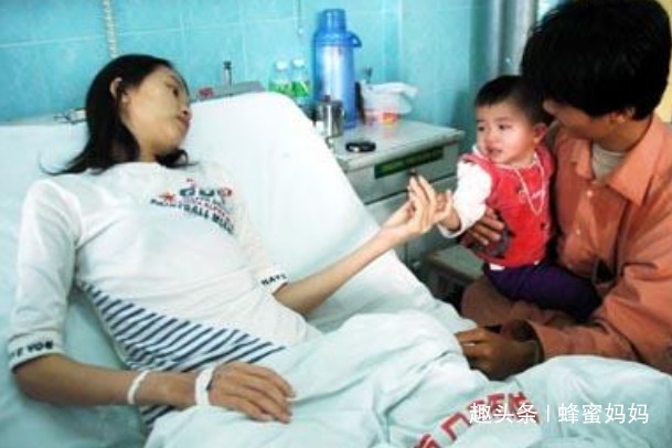 肚子|产妇刚生完娃,肚子仍“鼓的”像怀孕8个月,医生手术后对不起