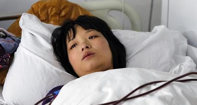 小知识|“尿毒症”多是吃出来的，3种食物早忌口，肾可能会“感激”你