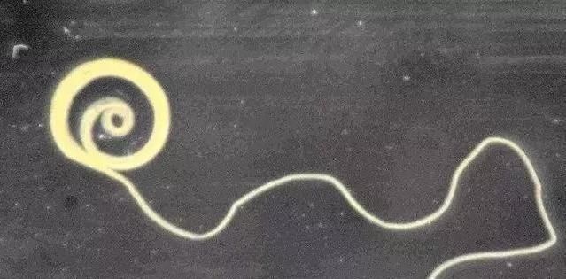 营养|这3种水果，含大量寄生虫，为了孩子身体好，再营养也别给孩子吃