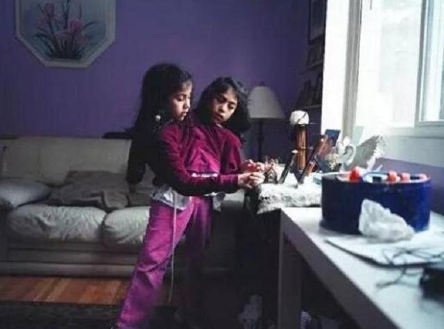 孩子|17年前的连体女婴,医生说“只能活3天”,如今现状超乎众人意料