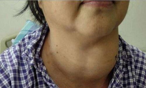 橘子营养丰富好处多,吃完橘子之后1小时,3种食