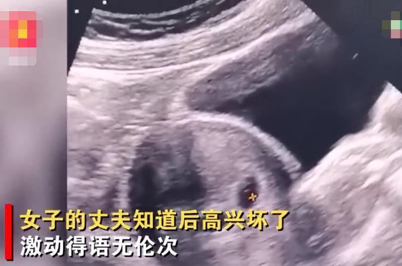 生长发育|男子得知妻子怀上双胞胎,激动得语无伦次,网友看完B超:外星人
