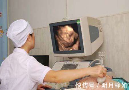 检查|孕妇做四维彩超时不能有家属陪同了解原因后,要充分配合医生