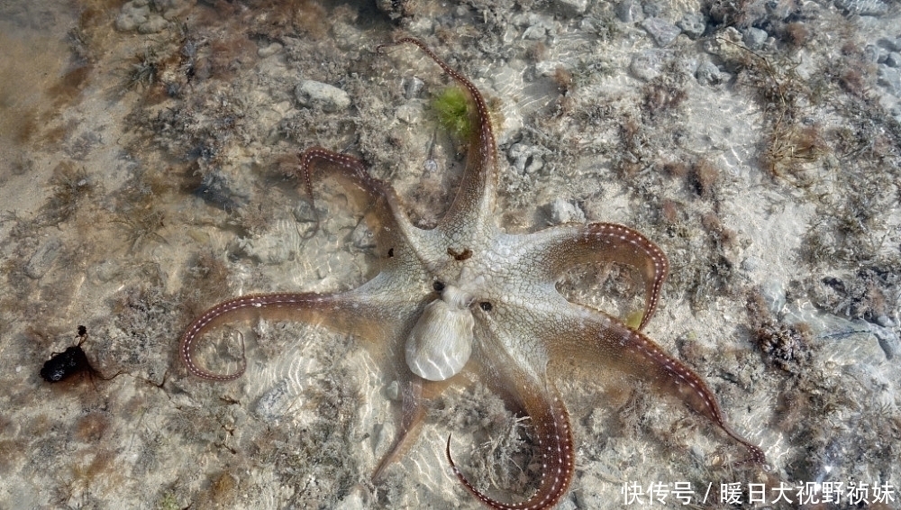 血脂|血脂高者吃这些食物“加速”脑梗发作，尤其是第二种，再馋也别碰