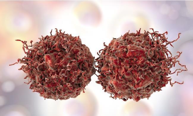 癌细胞|癌症能不能治愈？肿瘤专家：满足这三个条件，就可以