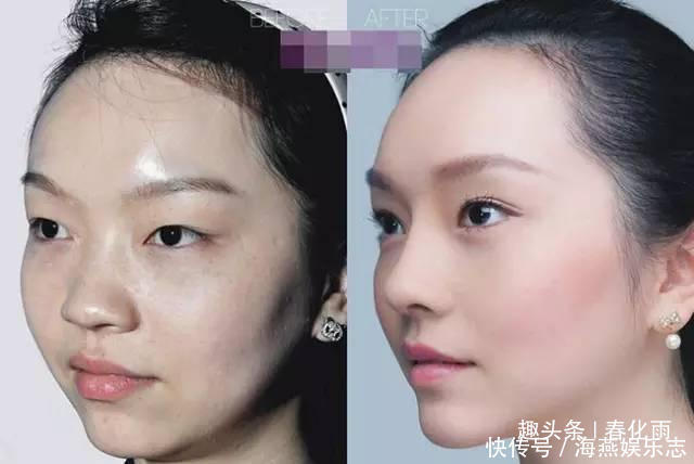 实拍：10张女孩整容前后的对比照，这真就是换了一张脸