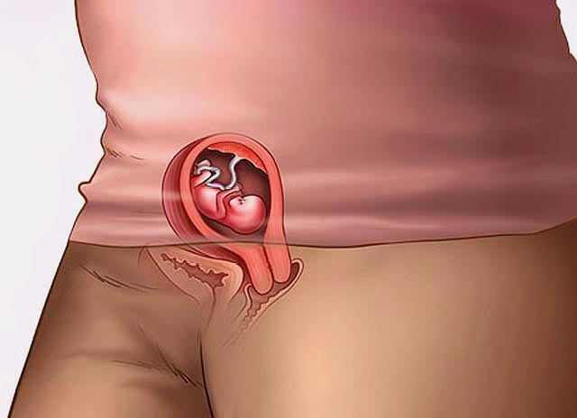 受精卵|怀孕有多辛苦五张图带你看看孕期全过程,孕妈们辛苦了