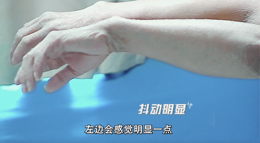 父母近亲结婚 他全身长满 鱼鳞 一抠就掉 全网搜