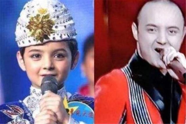 习惯|这5种孩子会越长越丑，长大也难摆脱“变丑”结局，尽早改正